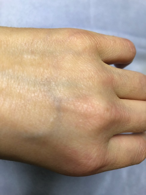 馬油うるおいクリーム塗った後